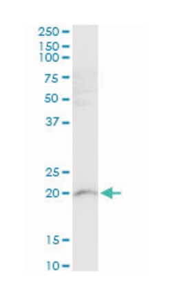 ribosomal protein L21, Mouse, Polyclonal Antibody, Abnova 50&mu;L; Unlabeled:Antibodies,