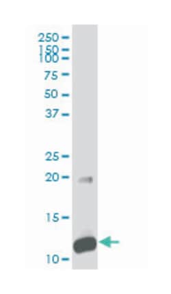 S100 calcium binding protein A5, Mouse, Polyclonal Antibody, Abnova 50&mu;L;