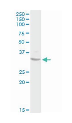 SDHB, Rabbit, Purified MaxPab Polyclonal Antibody, Abnova 100&mu;g; Unlabeled:Antibodies,