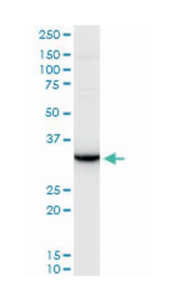 sex hormone-binding globulin, Mouse, Polyclonal Antibody, Abnova 50&mu;L;