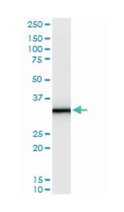 sex hormone-binding globulin, Mouse, Polyclonal Antibody, Abnova 50&mu;L;