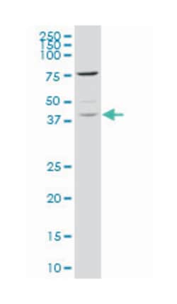TAF7 RNA polymerase II, TATA box binding protein (TBP)-associated factor,