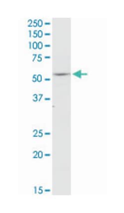 thyroid hormone receptor, alpha (erythroblastic leukemia viral (v-erb-a)