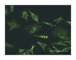 TXK tyrosine kinase, Mouse, Clone: 2D8, Abnova 100&mu;g; Unlabeled:Antibodies,