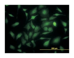 thymidylate synthetase, Mouse, Clone: 3A1, Abnova&trade;
