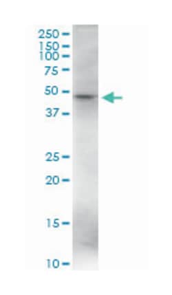 VDR, Rabbit, MaxPab Polyclonal Antibody, Abnova 100 &mu;L | Buy Online | Abnova | Fisher Scientific