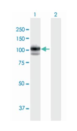 glucosidase, alpha; acid, Mouse, Purified MaxPab Polyclonal Antibody, Abnova
