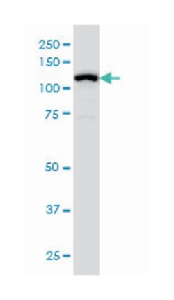 GABBR1, Mouse, Clone: 2D7, Abnova 100&mu;g; Unlabeled:Antibodies, Monoclonal