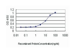 GABBR1, Mouse, Clone: 2D7, Abnova 100&mu;g; Unlabeled:Antibodies, Monoclonal