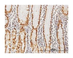 GABPA, Mouse, Clone: 5C8, Abnova 100 &mu;g | Buy Online | Abnova Corporation | Fisher Scientific