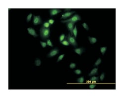 GABPA, Mouse, Clone: 5C8, Abnova 100 &mu;g | Buy Online | Abnova Corporation | Fisher Scientific