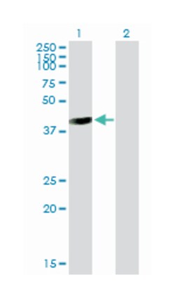 galactose-1-phosphate uridylyltransferase, Mouse, Purified MaxPab Polyclonal