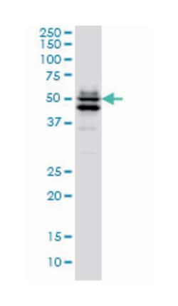 GATA binding protein 2, Mouse, Clone: 1G5, Abnova 100&mu;g; Unlabeled:Anticuerpos
