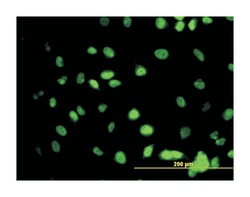 GATA binding protein 2, Mouse, Clone: 1G5, Abnova 100&mu;g; Unlabeled:Anticuerpos