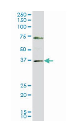gastrulation brain homeobox 2, Mouse, Clone: 2D8, Abnova&trade;