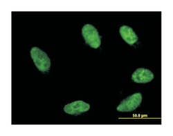 gastrulation brain homeobox 2, Mouse, Clone: 2D8, Abnova&trade;