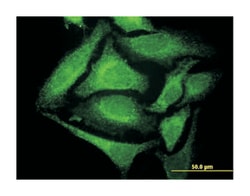 GTP cyclohydrolase 1, Mouse, Clone: 2C4, Abnova 100 &mu;g | Buy Online | Abnova Corporation | Fisher Scientific