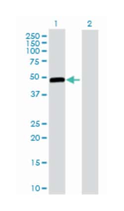 glucokinase (hexokinase 4), Rabbit, Purified MaxPab Polyclonal Antibody,