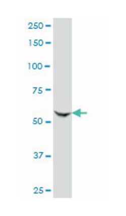 GCN5L2, Mouse, Clone: 3F8, Abnova 100&mu;g; Unlabeled:Antibodies, Monoclonal