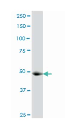 GCN5L2, Mouse, Clone: 3F8, Abnova 100&mu;g; Unlabeled:Antibodies, Monoclonal