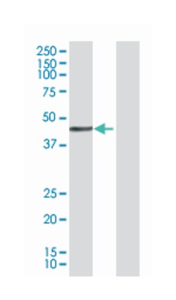 GLI-Kruppel family member GLI4, Mouse, Polyclonal Antibody, Abnova 50 &mu;L | Buy Online | Abnova Corporation | Fisher Scientific