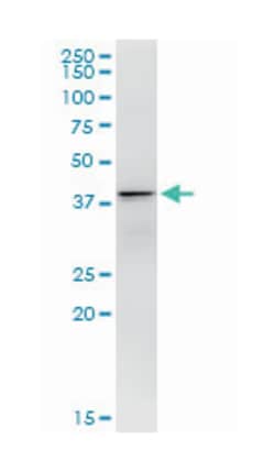 dynein, axonemal, light intermediate chain 1, Mouse, Clone: 2H3, Abnova