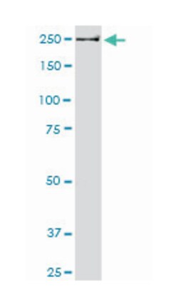 USP9X, Mouse, Clone: 5D7, Abnova 200&mu;L; Unlabeled:Antibodies, Monoclonal