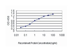 breast cancer anti-estrogen resistance 3, Mouse, Clone: 3G4, Abnova 100 &mu;g | Buy Online | Abnova | Fisher Scientific