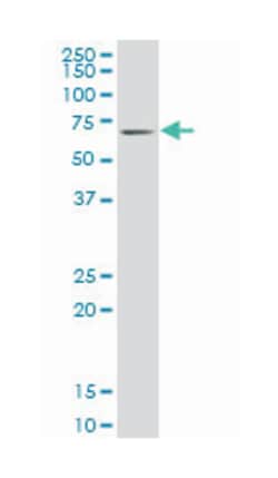 Kruppel-like factor 11, Mouse, Clone: 10D8, Abnova&trade;
