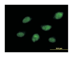 CDC14 cell division cycle 14 homolog B (S. cerevisiae), Mouse, Purified MaxPab Polyclonal Antibody, Abnova 50 &mu;g | Buy Online | Abnova Corporation | Fisher Scientific