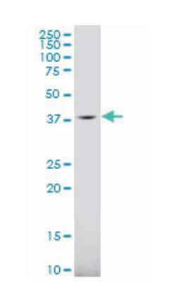 galactokinase 1, Mouse, Polyclonal Antibody, Abnova 50&mu;L; Unlabeled:Antibodies,
