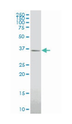 GBX2, Mouse, Clone: 4B11, Abnova 100 &mu;g | Buy Online | Abnova | Fisher Scientific