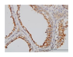 GGT1, Mouse, Clone: 1F9, Abnova 100&mu;g; Unlabeled:Antibodies, Monoclonal