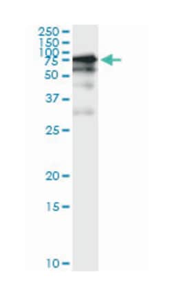 GGT1, Mouse, Clone: 1F9, Abnova 100&mu;g; Unlabeled:Antibodies, Monoclonal