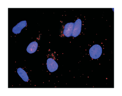 GHR, Mouse, Clone: 3A12, Abnova 100&mu;g; Unlabeled:Antibodies, Monoclonal