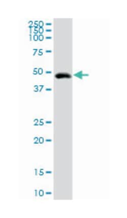 gastric intrinsic factor (vitamin B synthesis), Rabbit, Purified MaxPab