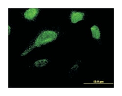 GLE1, Mouse, Clone: 1D8, Abnova 100&mu;g; Unlabeled:Antibodies, Monoclonal