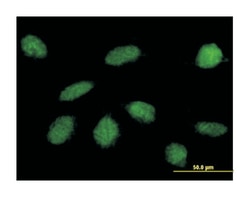GLI-Kruppel family member GLI4, Mouse, Polyclonal Antibody, Abnova 50 &mu;L | Buy Online | Abnova Corporation | Fisher Scientific