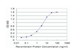 GLRA1, Mouse, Clone: 2G4, Abnova 100 &mu;g | Buy Online | Abnova Corporation | Fisher Scientific
