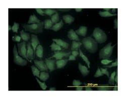 glutaminase, Mouse, Clone: 5C4, Abnova 100&mu;g; Unlabeled:Antibodies,
