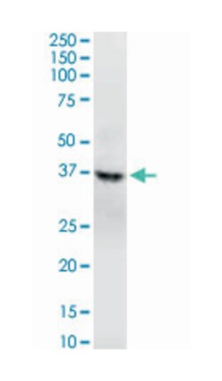 GNAQ, Mouse, Clone: 3B9, Abnova 100 &mu;g | Buy Online | Abnova | Fisher Scientific