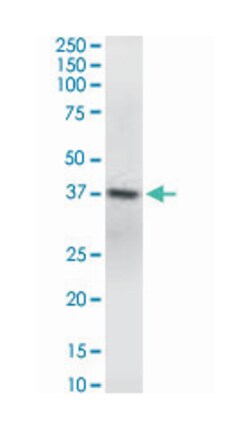 GNAQ, Mouse, Clone: 3B9, Abnova 100 &mu;g | Buy Online | Abnova | Fisher Scientific