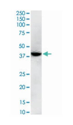 GNAQ, Mouse, Clone: 3B9, Abnova 100 &mu;g | Buy Online | Abnova | Fisher Scientific