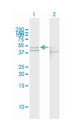 glutamic-oxaloacetic transaminase 1, soluble (aspartate aminotransferase