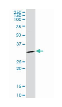 SFN, Mouse, Clone: 1E6, Abnova 100 &mu;g | Buy Online | Abnova Corporation | Fisher Scientific