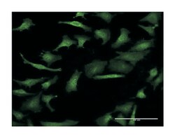 GIF, Mouse, Clone: 1D9, Abnova 100 &mu;g | Buy Online | Abnova | Fisher Scientific