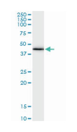 gap junction protein, alpha 1, 43kDa, Mouse, Clone: 3E5, Abnova&trade;