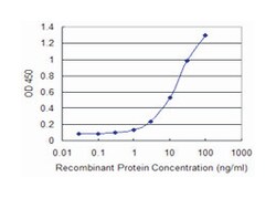 GJB1, Mouse, Clone: 2B9, Abnova 100 &mu;g | Buy Online | Abnova | Fisher Scientific