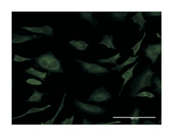 SFN, Mouse, Clone: 1E6, Abnova 100 &mu;g | Buy Online | Abnova Corporation | Fisher Scientific