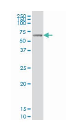 GRK6, Mouse, Clone: 8B7, Abnova 100 &mu;g | Buy Online | Abnova | Fisher Scientific